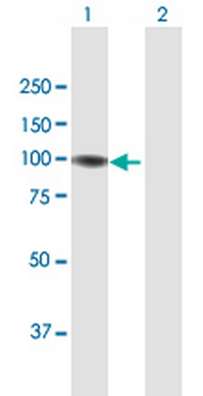 GNL2 Antibody in Western Blot (WB)