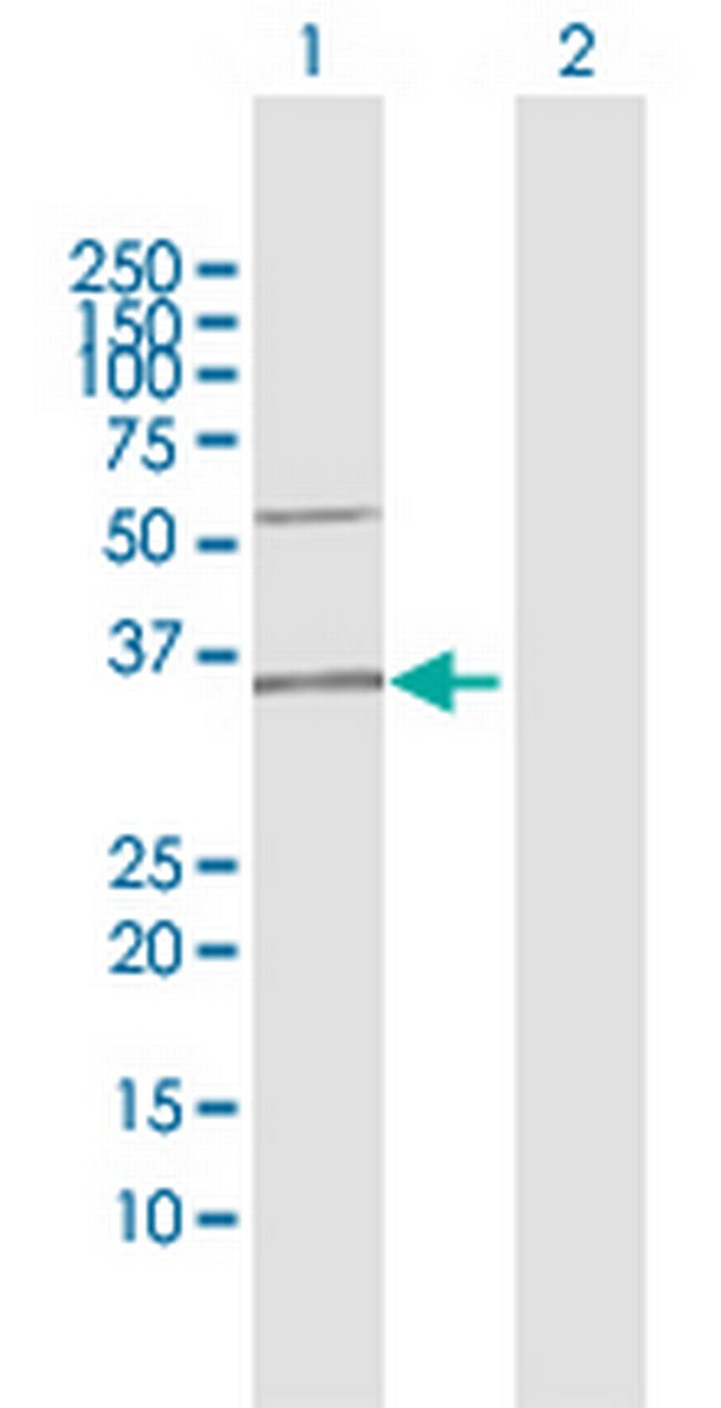 C12orf24 Antibody in Western Blot (WB)