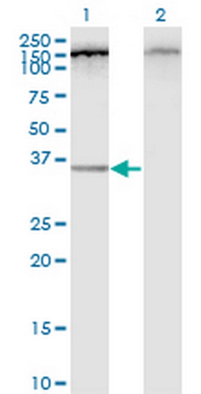 C12orf24 Antibody in Western Blot (WB)