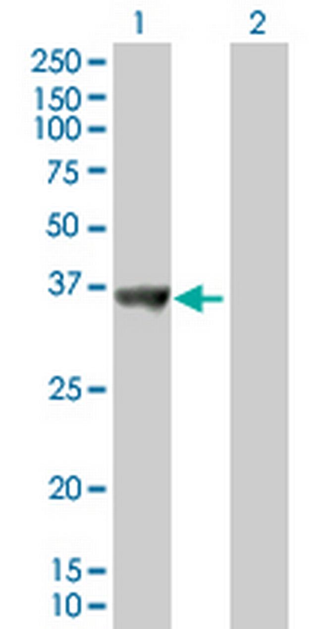 SNX11 Antibody in Western Blot (WB)
