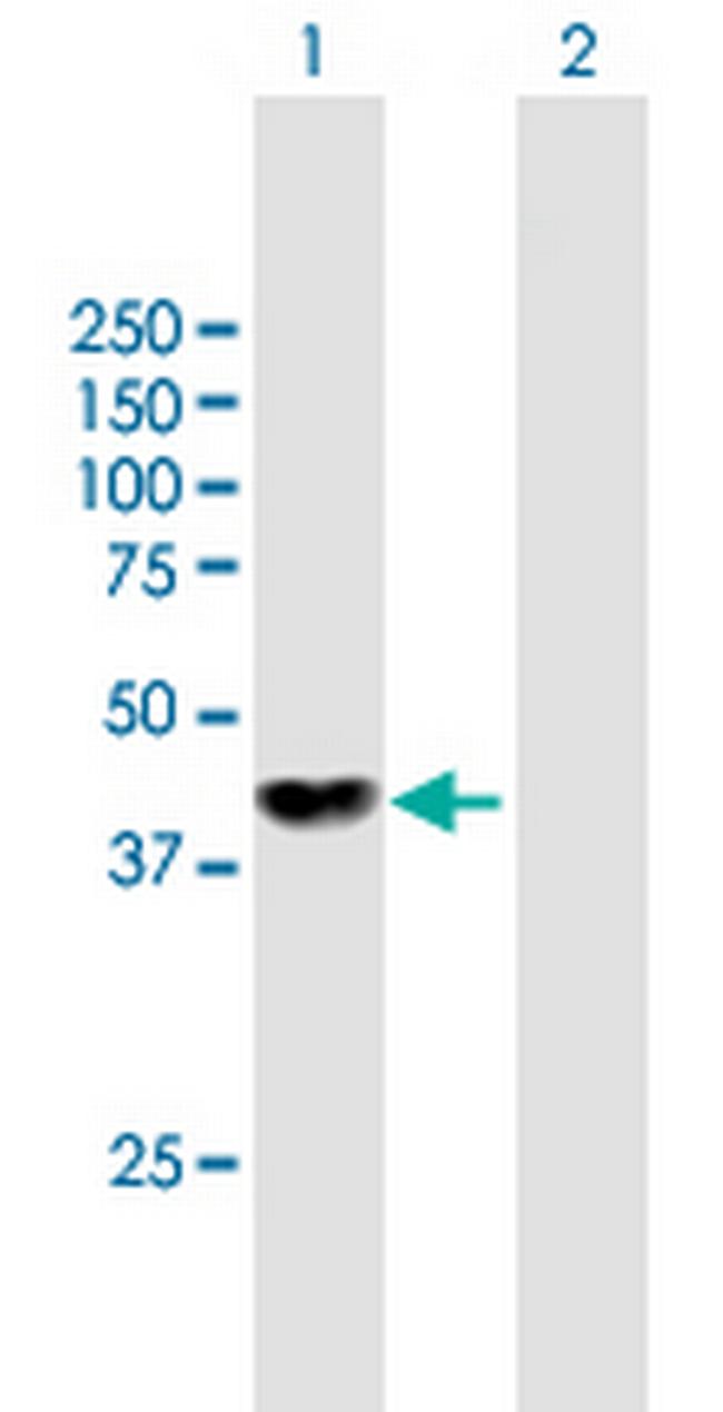 NME7 Antibody in Western Blot (WB)