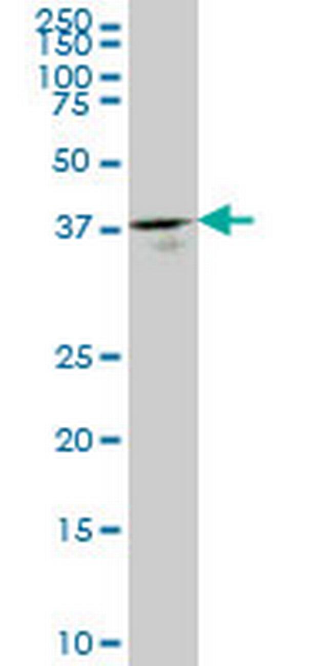 GMPPB Antibody in Western Blot (WB)