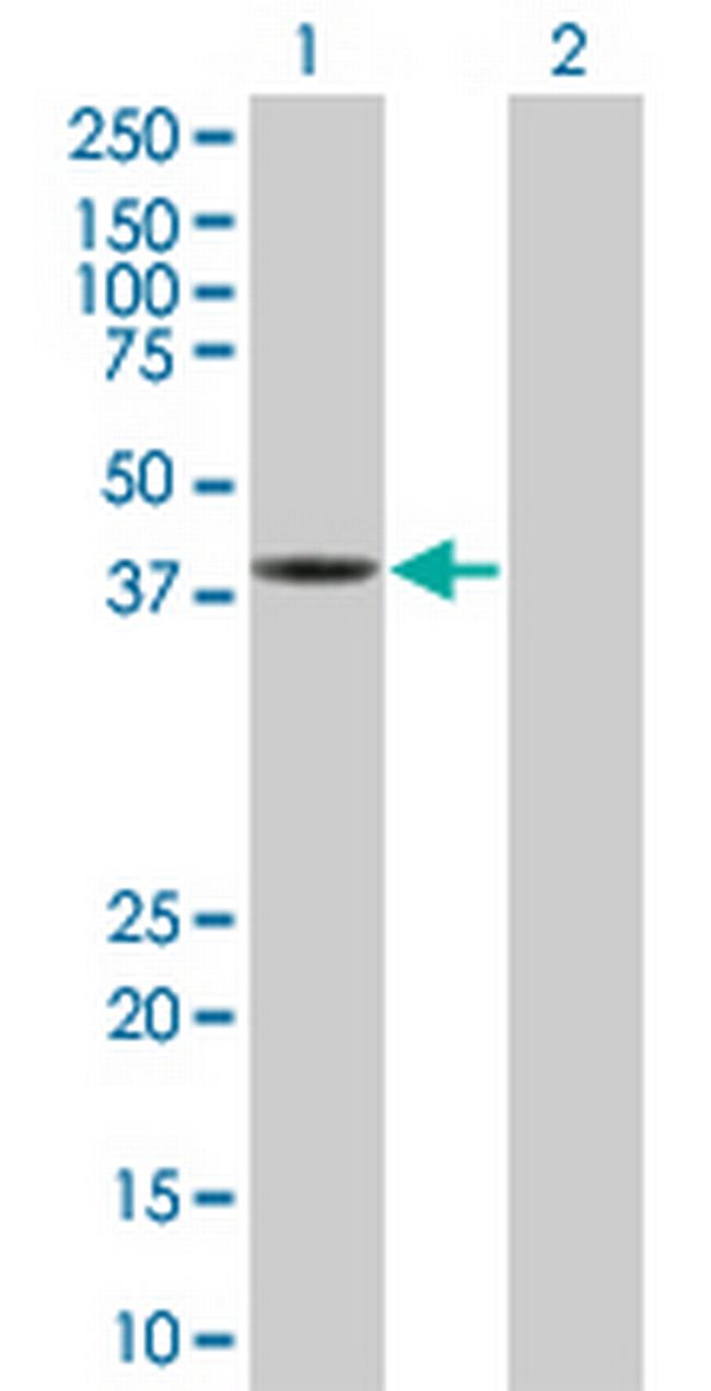GMPPA Antibody in Western Blot (WB)