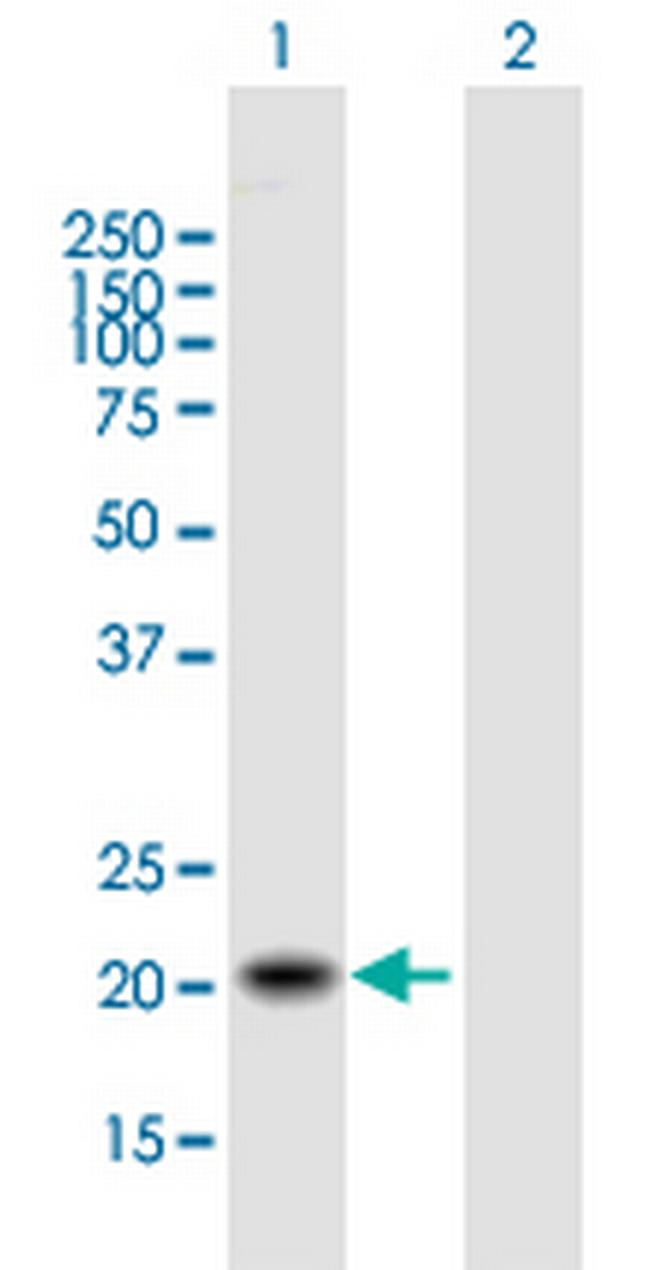 TIMM22 Antibody in Western Blot (WB)