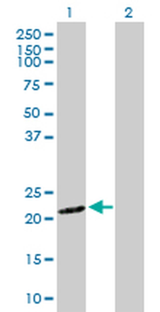 SNX12 Antibody in Western Blot (WB)