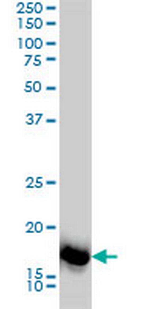 SNX12 Antibody in Western Blot (WB)