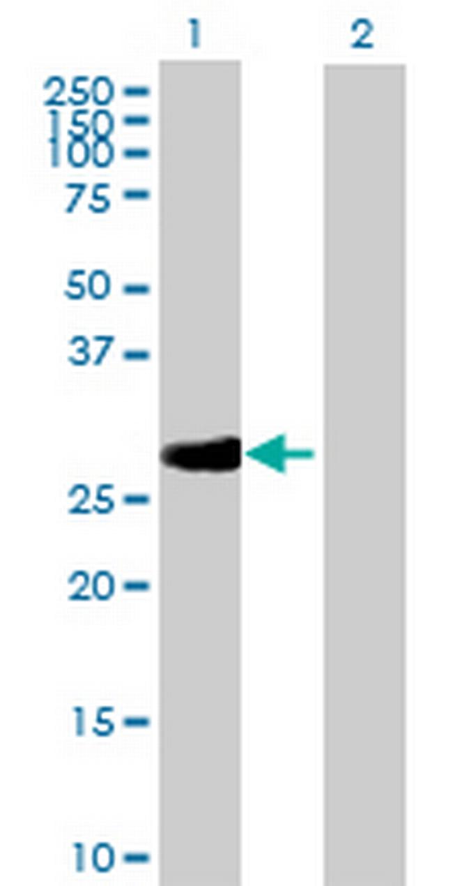 RPA4 Antibody in Western Blot (WB)
