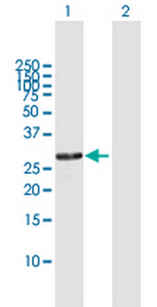 RPA4 Antibody in Western Blot (WB)