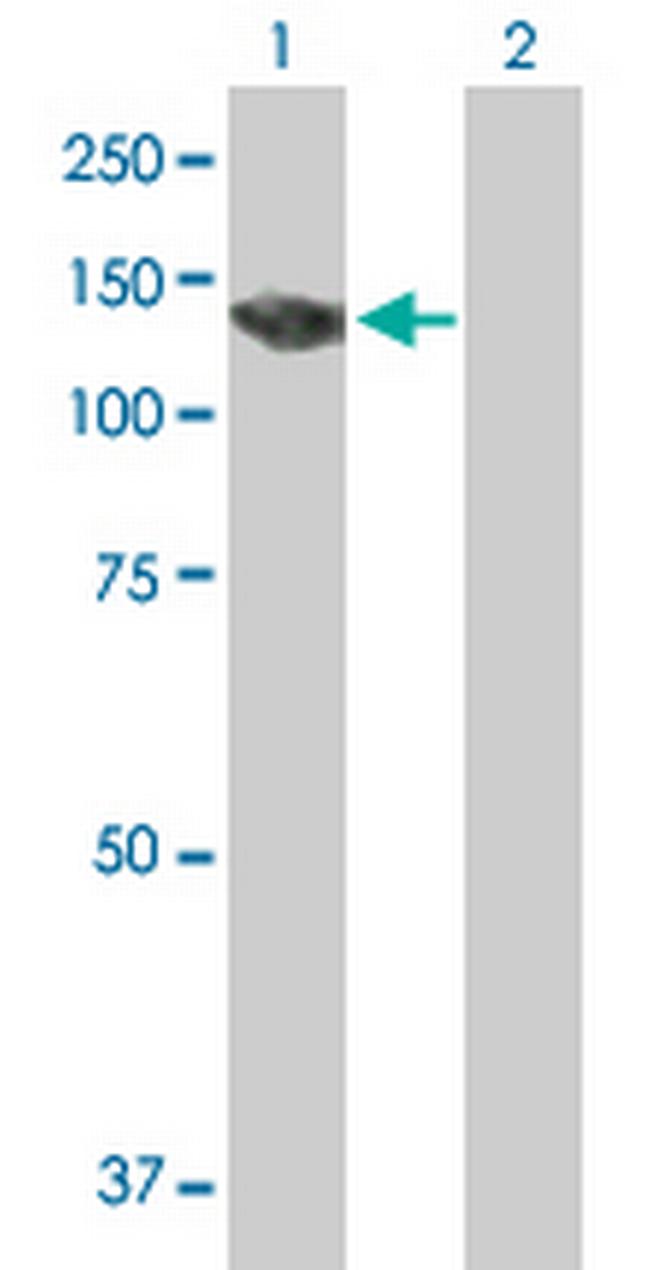 PKN3 Antibody in Western Blot (WB)