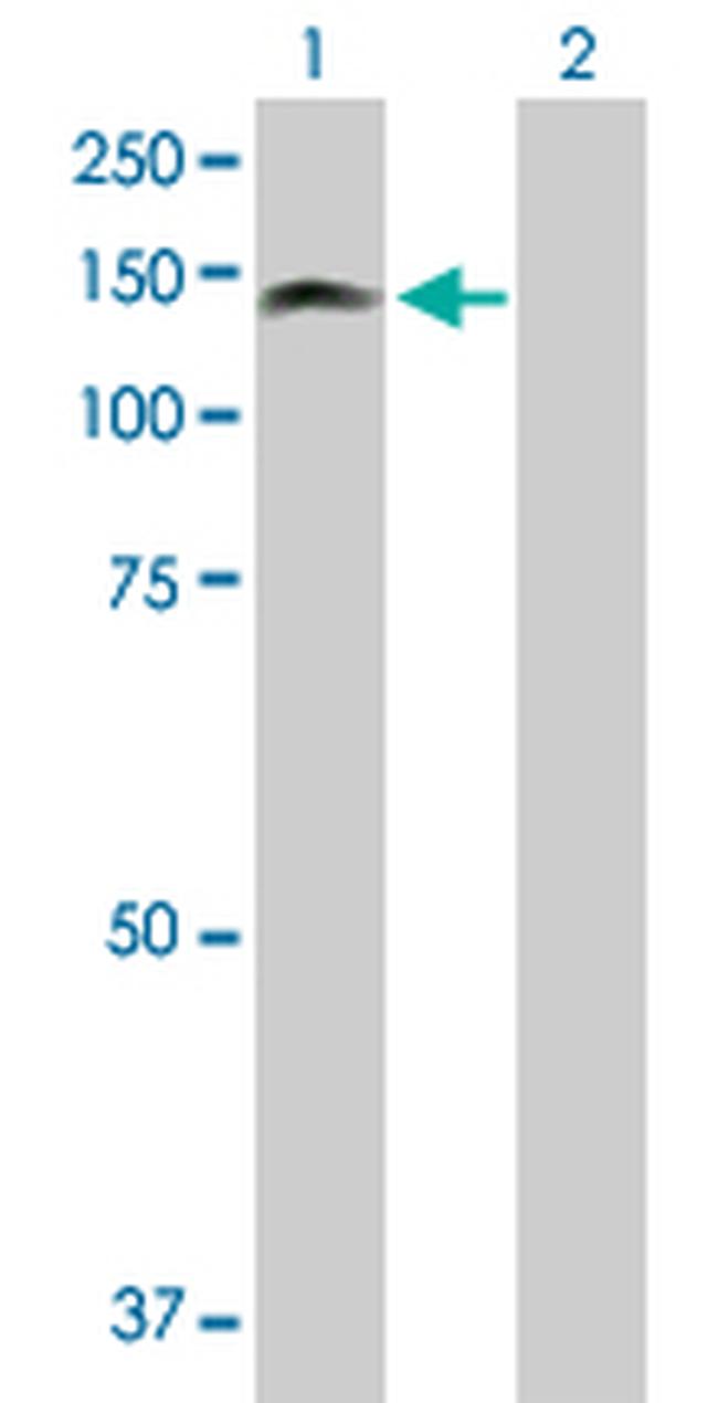 PKN3 Antibody in Western Blot (WB)
