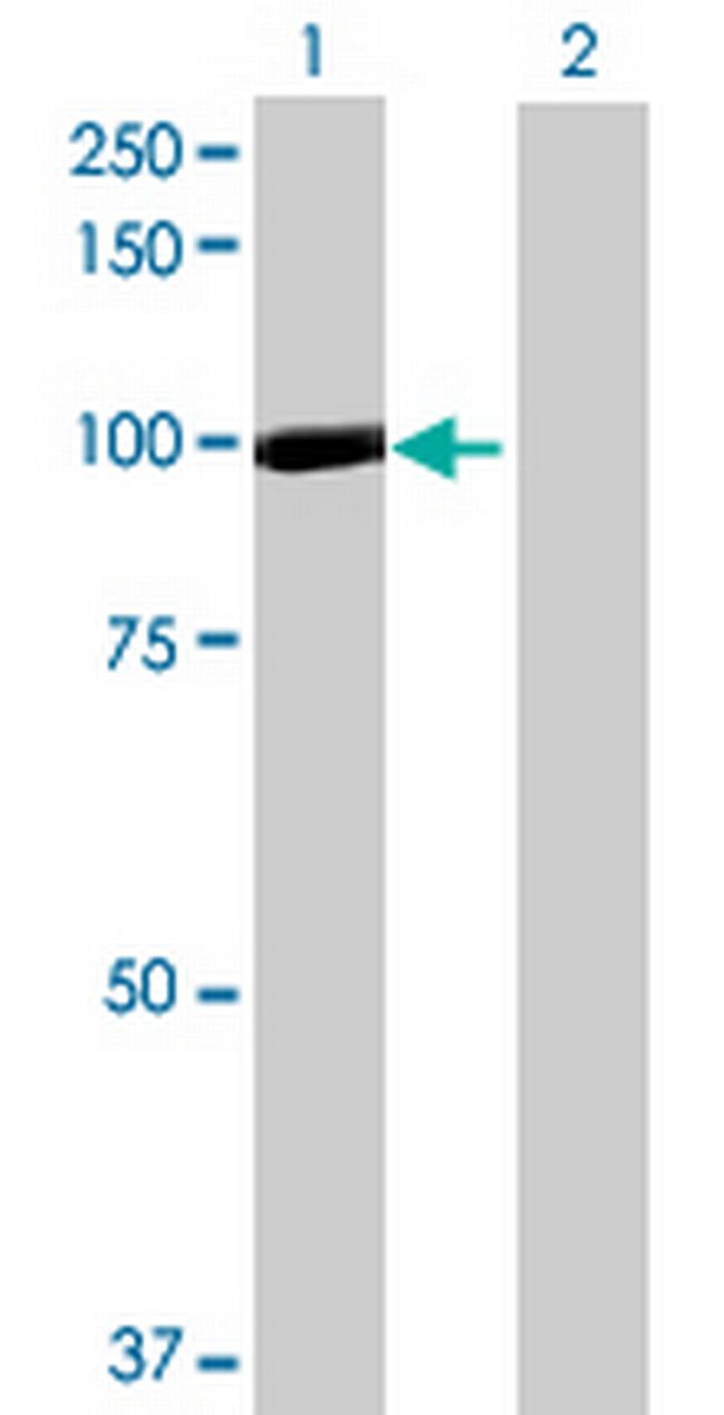 ANAPC4 Antibody in Western Blot (WB)