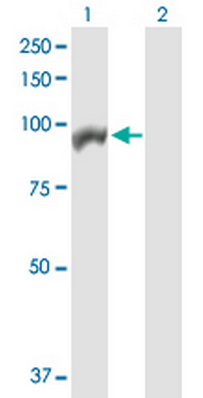 ANAPC4 Antibody in Western Blot (WB)