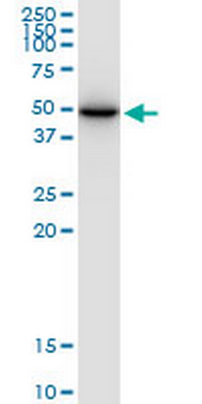 SLC25A24 Antibody in Western Blot (WB)