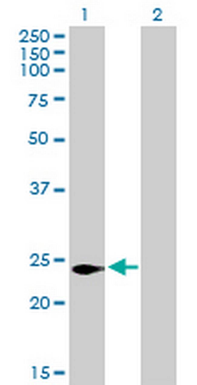 C16orf5 Antibody in Western Blot (WB)