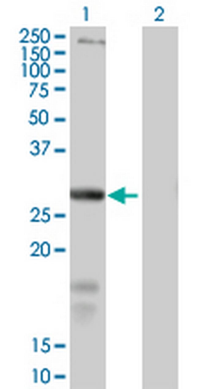 SLC39A3 Antibody in Western Blot (WB)