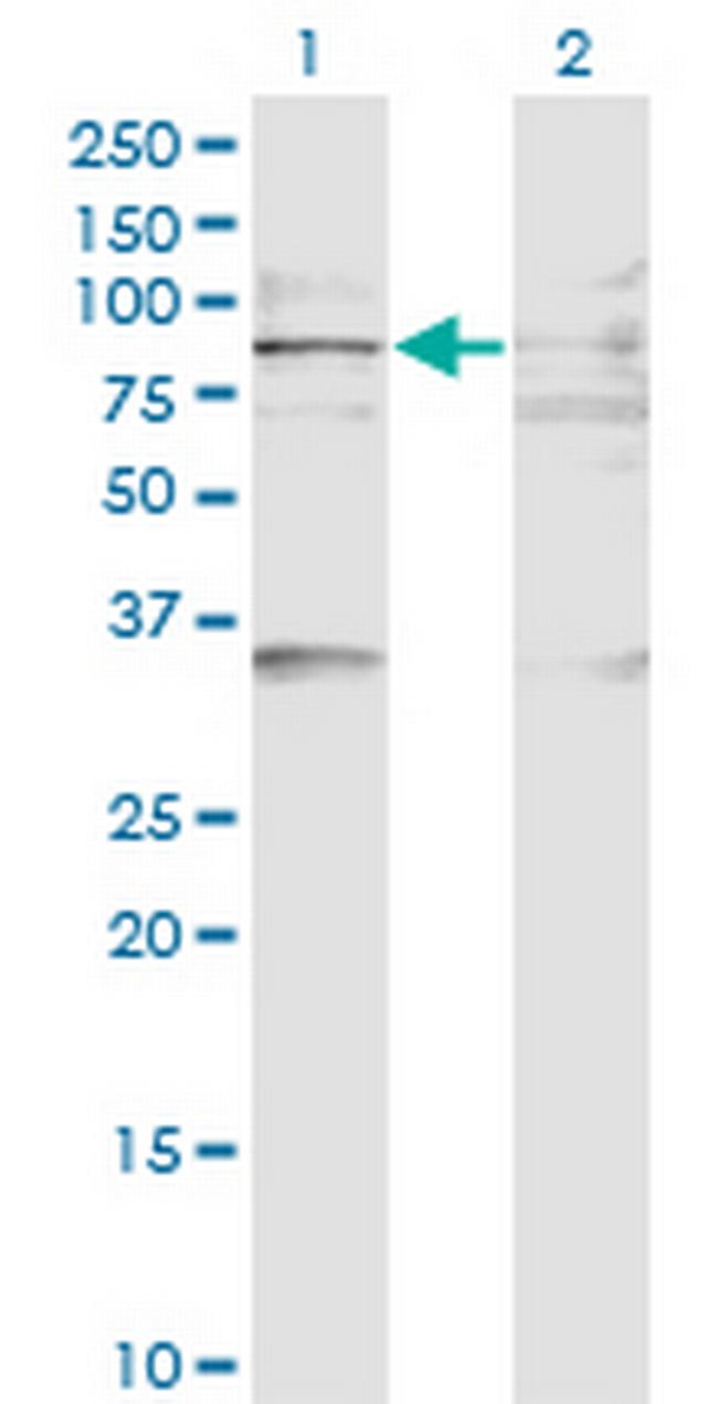 BAZ2B Antibody in Western Blot (WB)