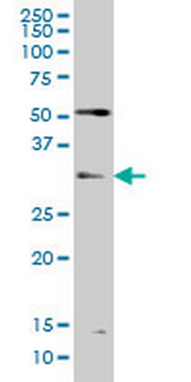 TLX3 Antibody in Western Blot (WB)