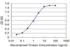 TLX3 Antibody in ELISA (ELISA)