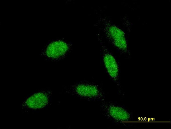 RAX Antibody in Immunocytochemistry (ICC/IF)