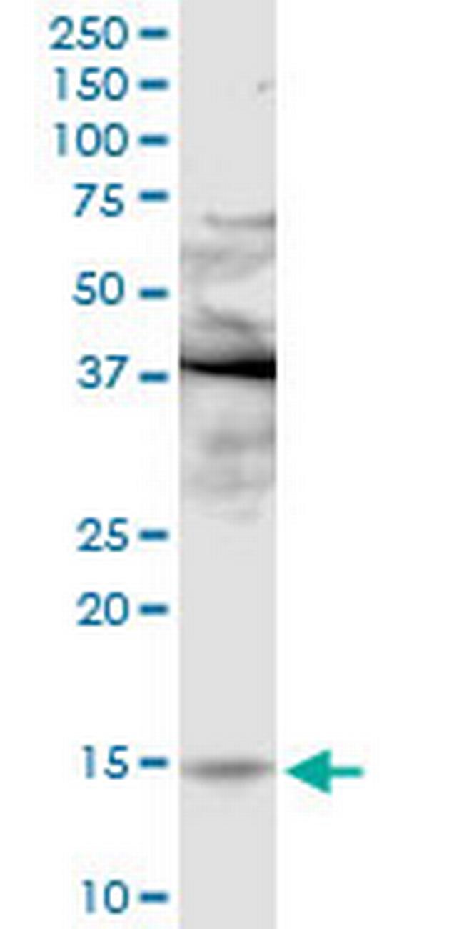 PLA2G2E Antibody in Western Blot (WB)