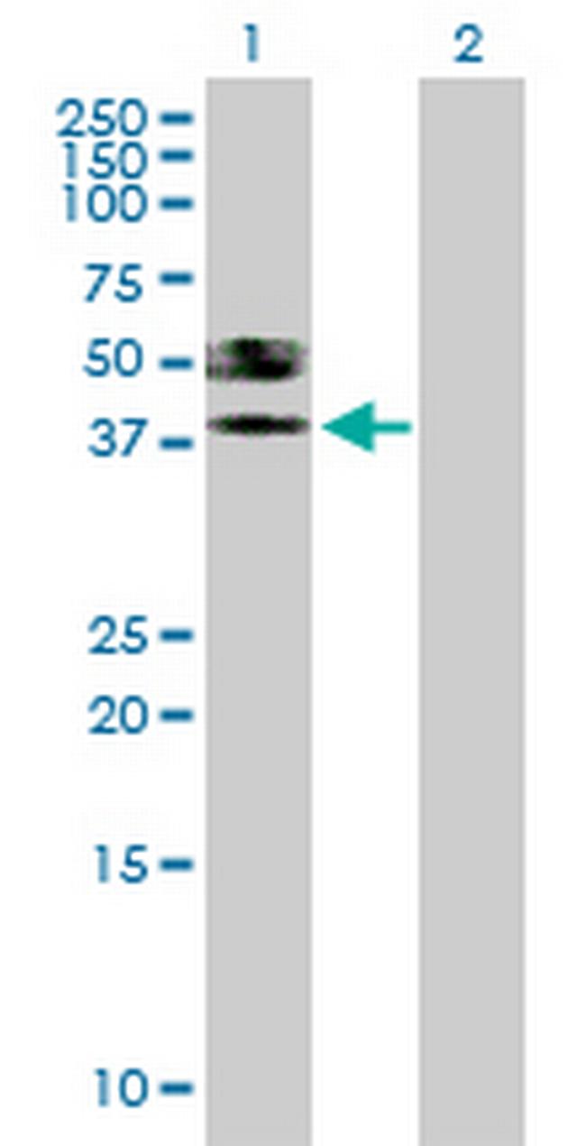 ST6GALNAC6 Antibody in Western Blot (WB)