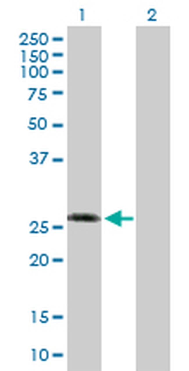 KCNIP3 Antibody in Western Blot (WB)