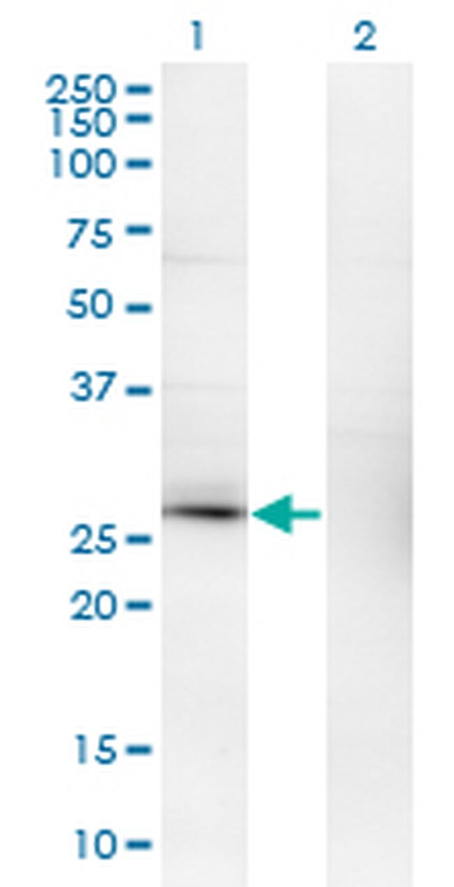 CSEN Antibody in Western Blot (WB)