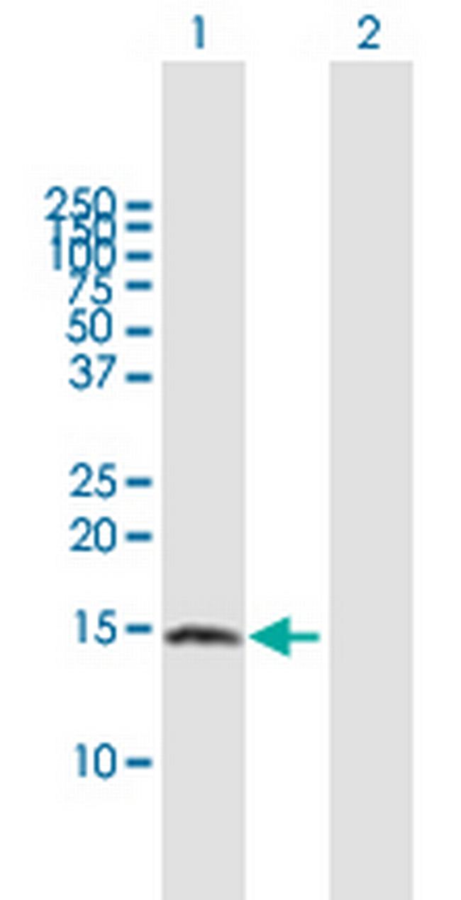 ZNRD1 Antibody in Western Blot (WB)
