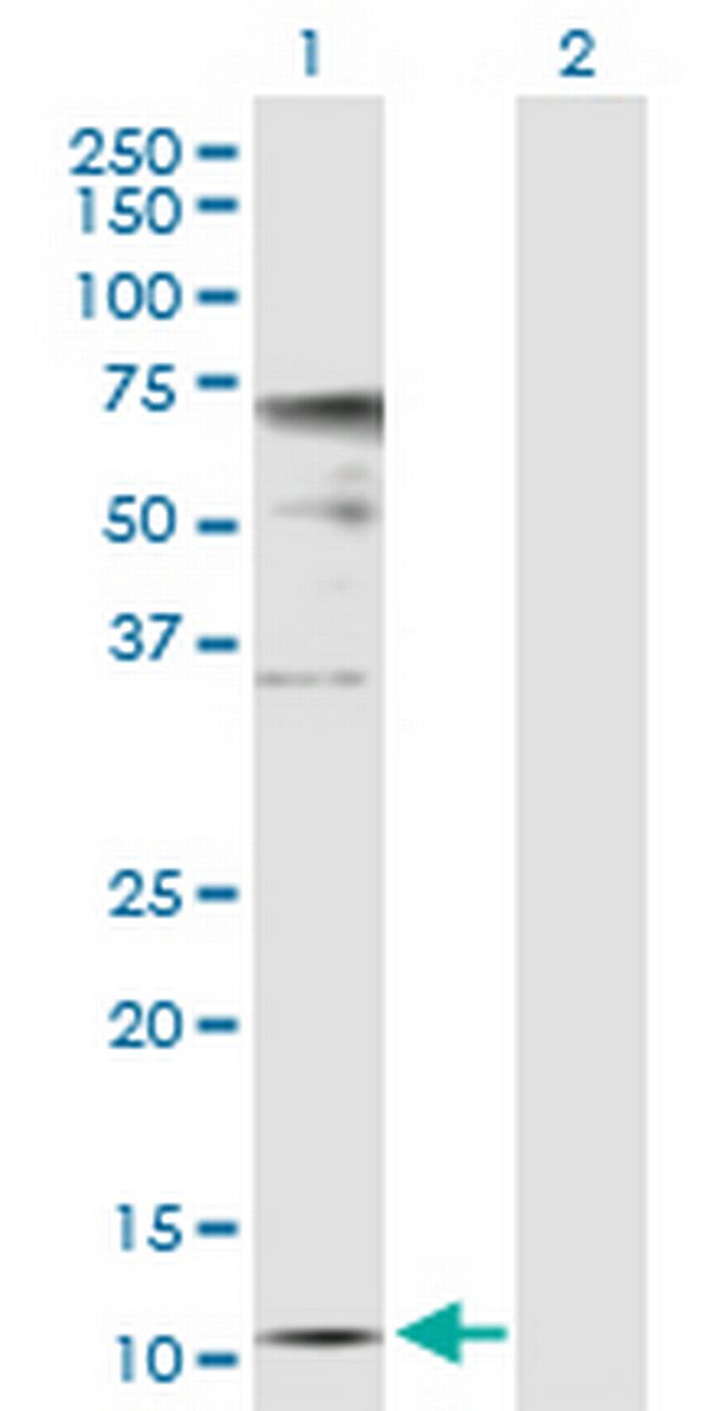 ZNRD1 Antibody in Western Blot (WB)