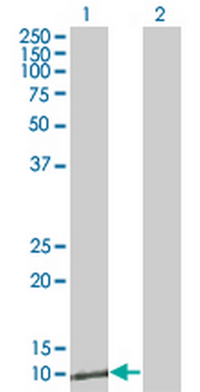 ZNRD1 Antibody in Western Blot (WB)
