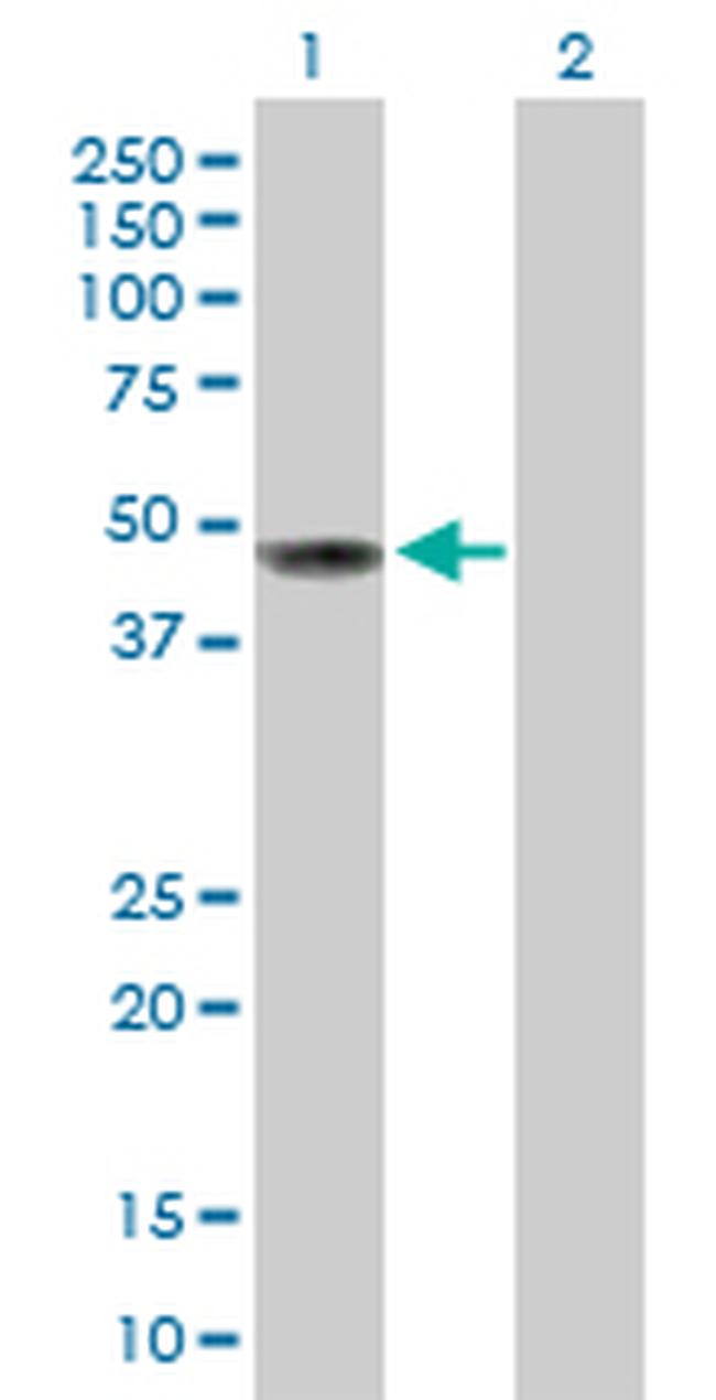 CD209 Antibody in Western Blot (WB)
