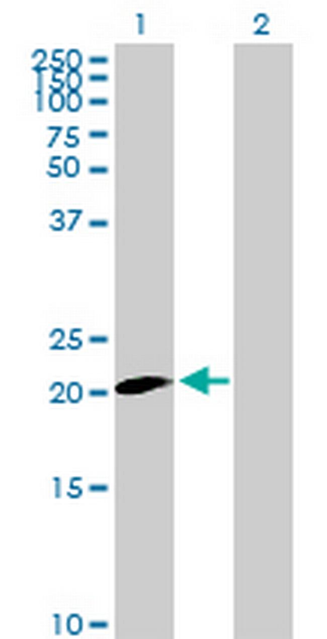 CLDN20 Antibody in Western Blot (WB)