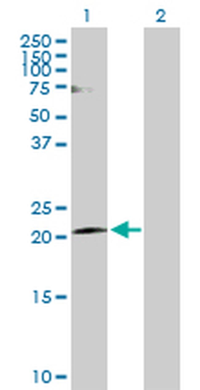 CLDN20 Antibody in Western Blot (WB)