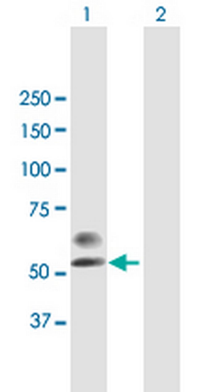PLA2G3 Antibody in Western Blot (WB)