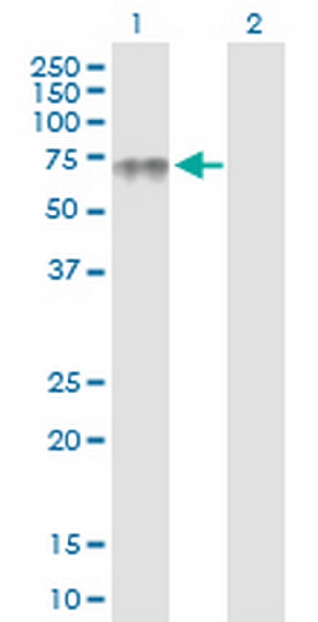 PLA2G3 Antibody in Western Blot (WB)