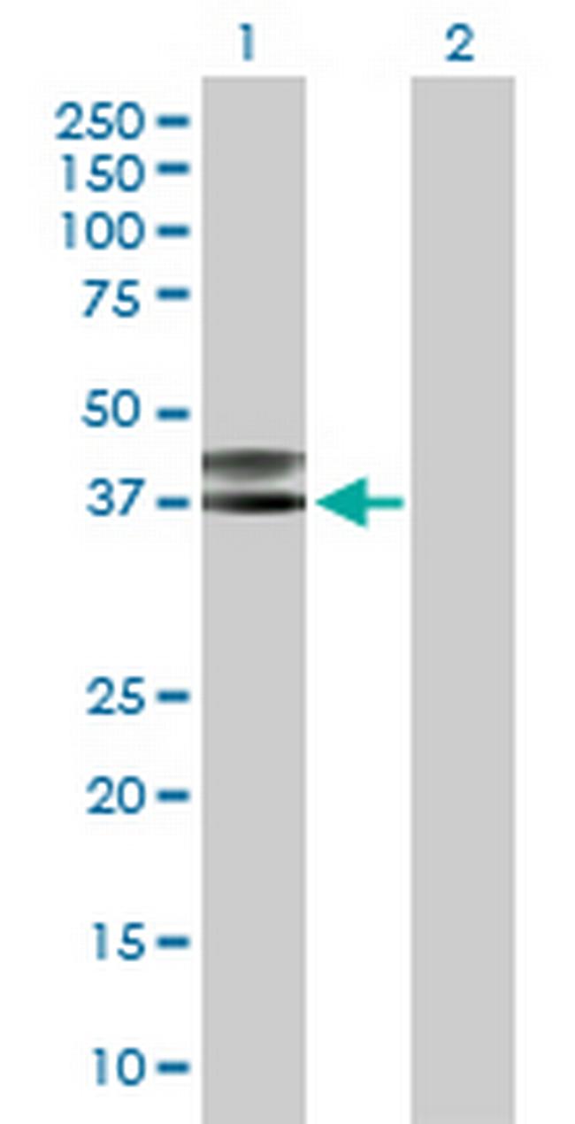 CD207 Antibody in Western Blot (WB)