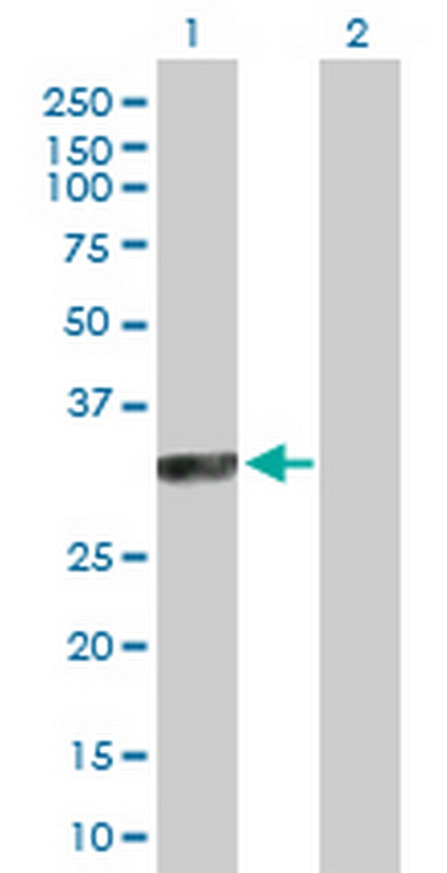SYCP3 Antibody in Western Blot (WB)