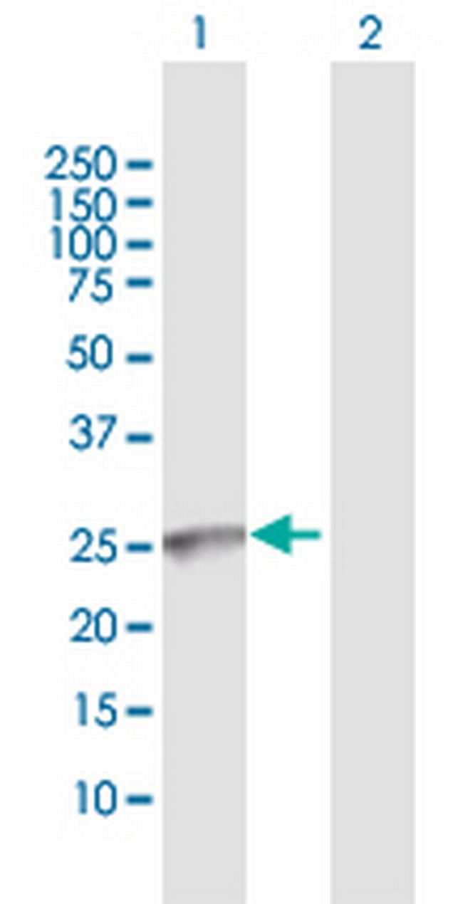 GALNT9 Antibody in Western Blot (WB)