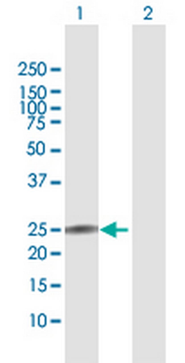 IL22 Antibody in Western Blot (WB)