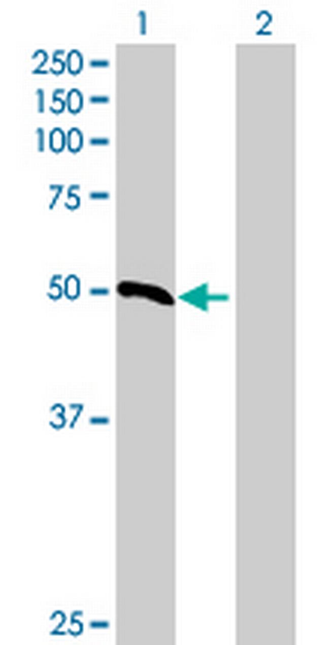RDH8 Antibody in Western Blot (WB)