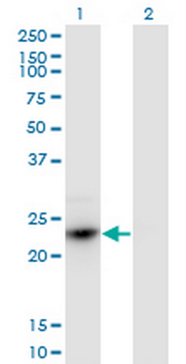 HDGFRP3 Antibody in Western Blot (WB)