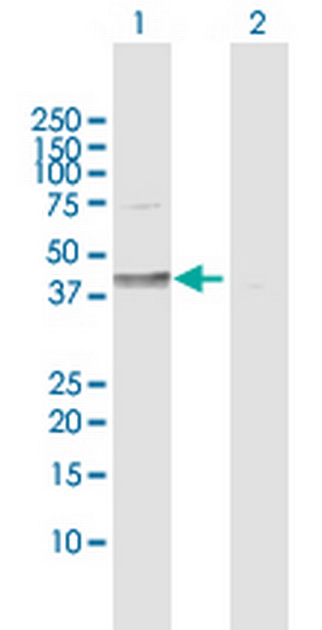 DHH Antibody in Western Blot (WB)