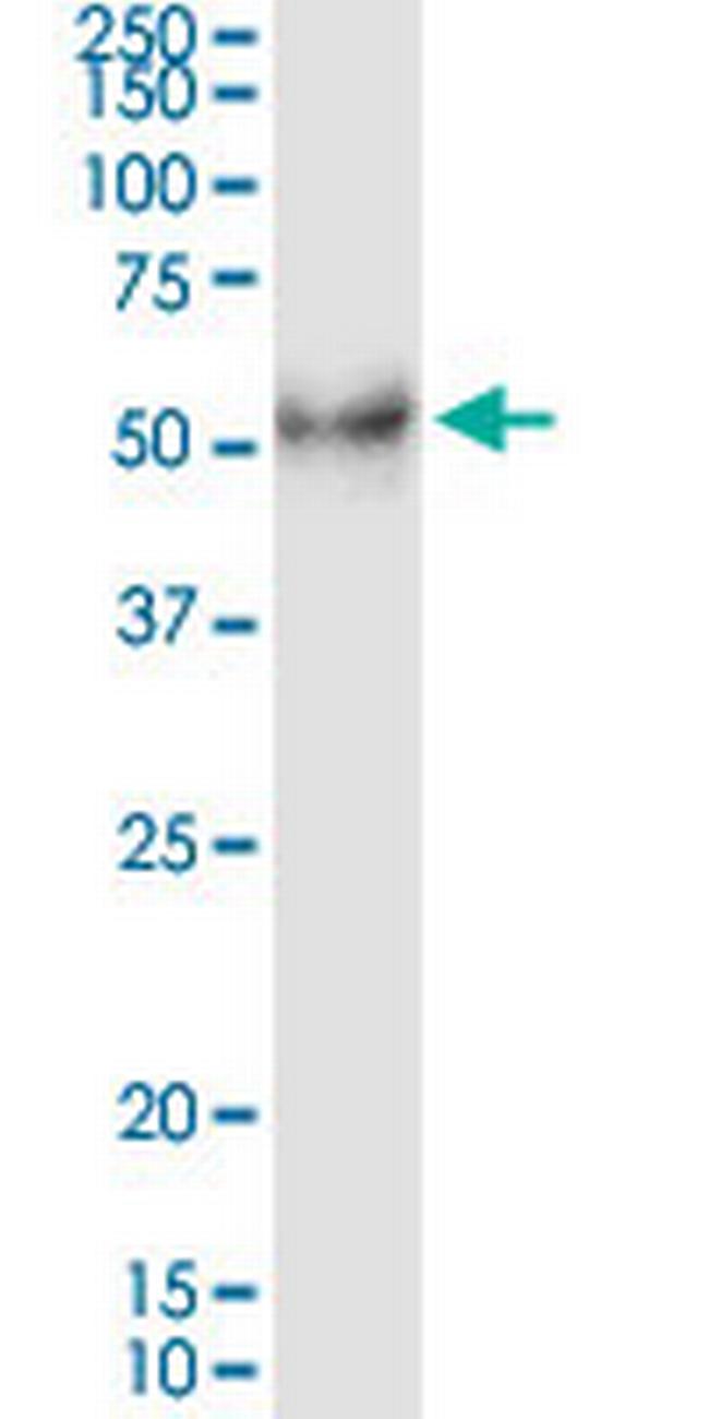 DHH Antibody in Western Blot (WB)