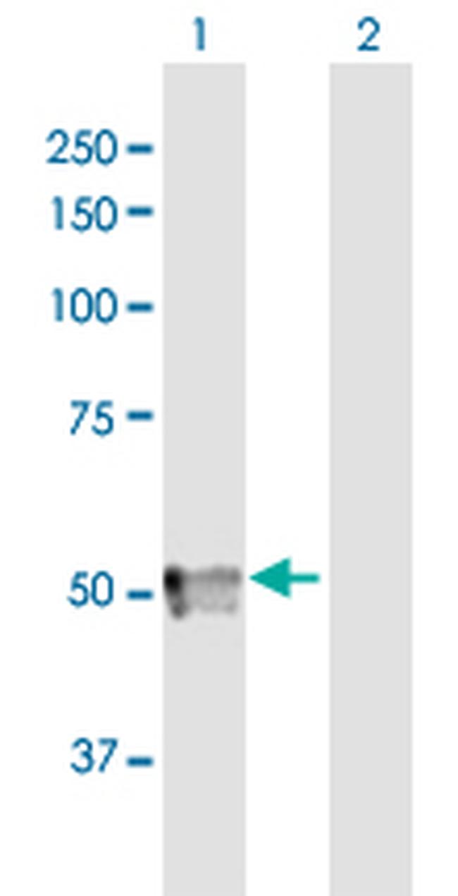 SPOCK3 Antibody in Western Blot (WB)