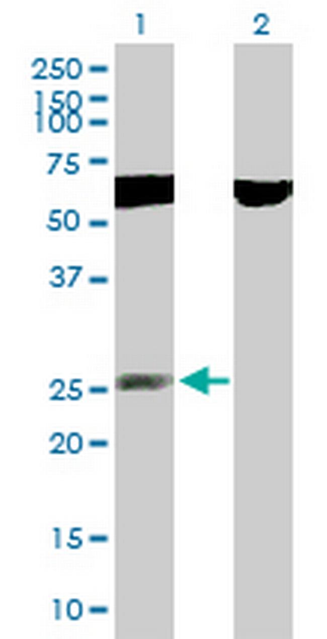 RNF141 Antibody in Western Blot (WB)