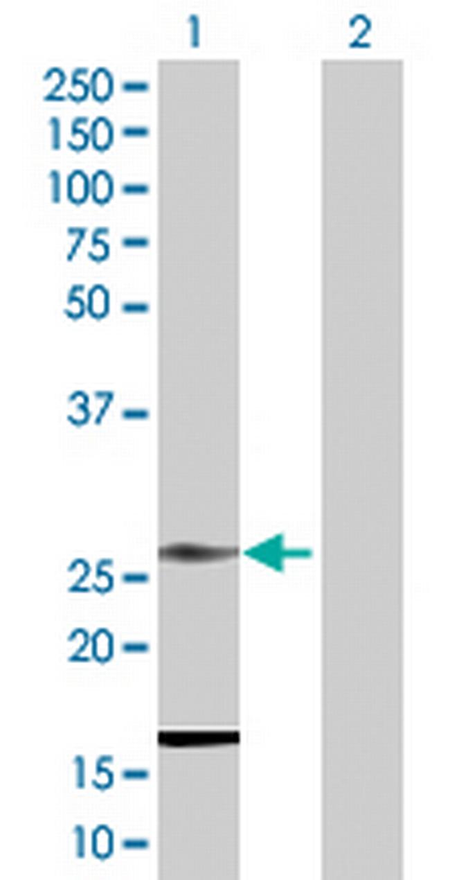 RNF141 Antibody in Western Blot (WB)
