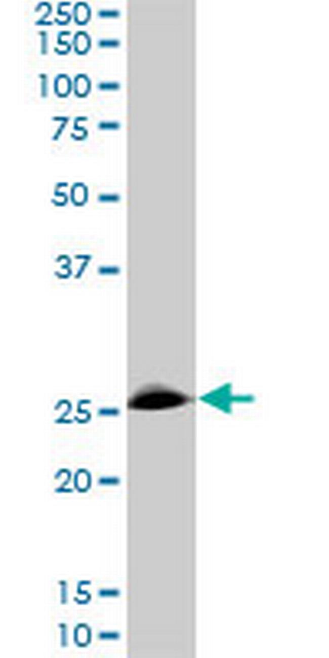 RNF141 Antibody in Western Blot (WB)