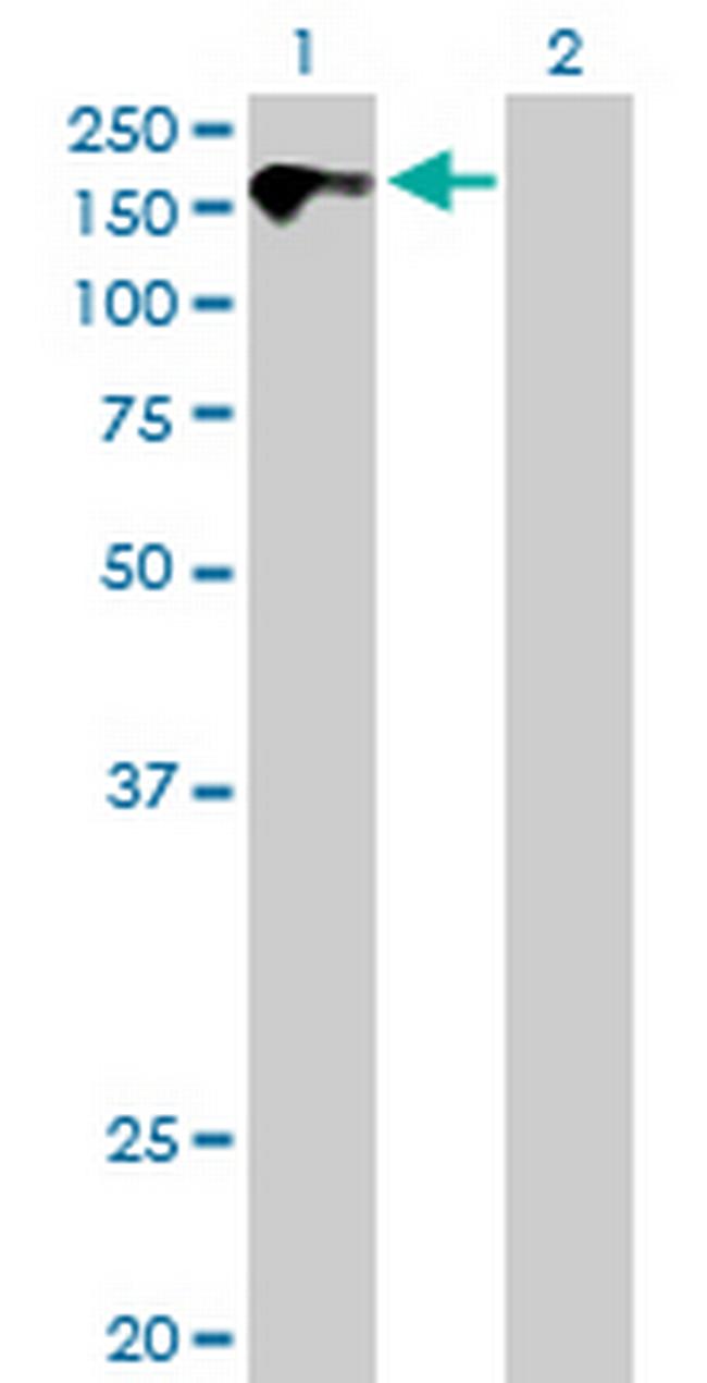 CDON Antibody in Western Blot (WB)