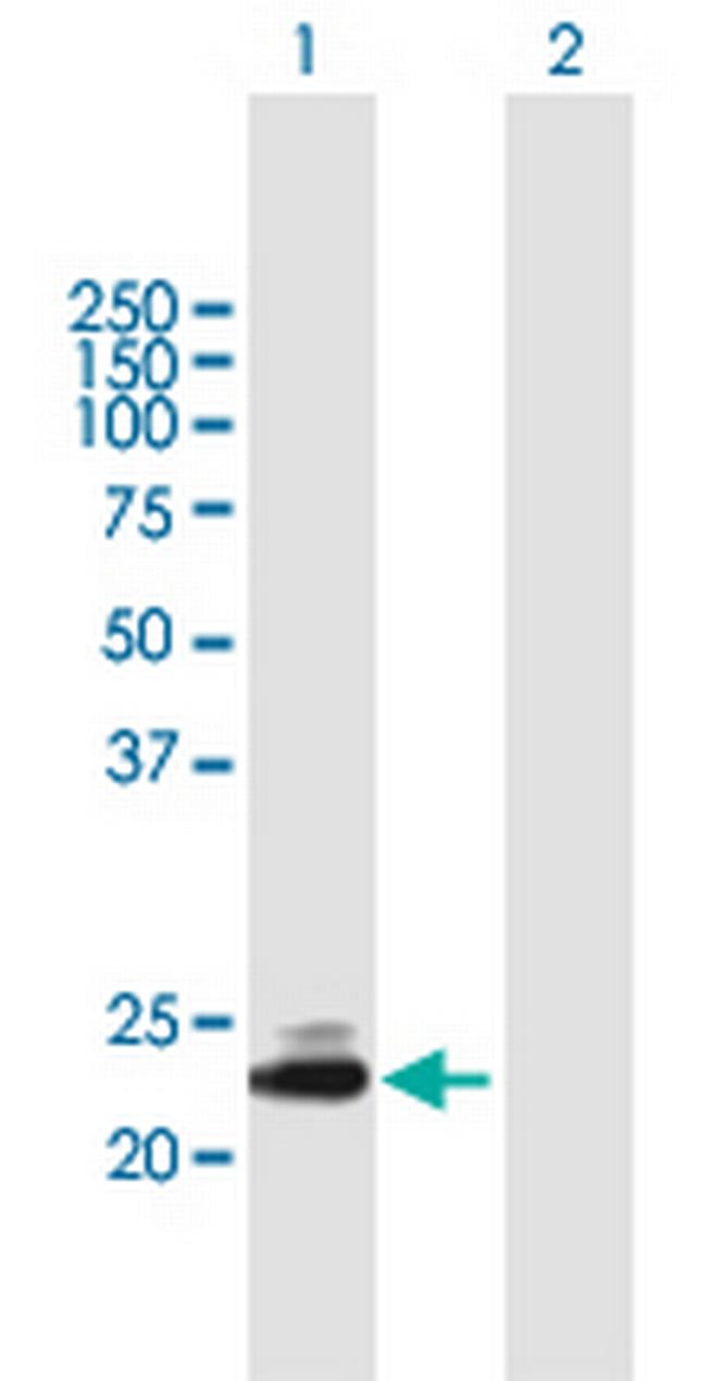 TMED5 Antibody in Western Blot (WB)