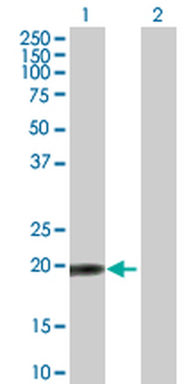 TPRKB Antibody in Western Blot (WB)